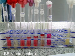 Dissertation vibrio cholerae
