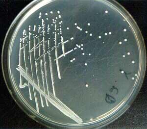 Nutrient Agar: Composi...
