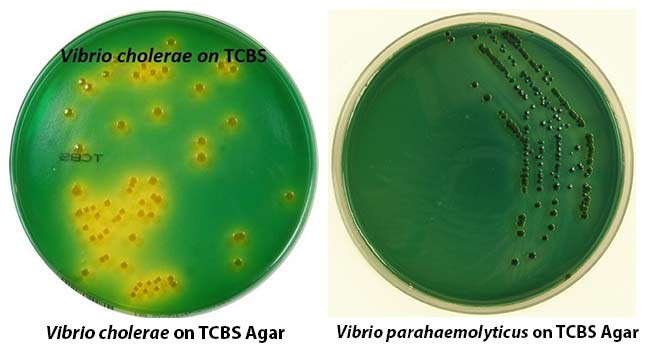 Colony-Morphology-on-TCBS-Agar.jpg
