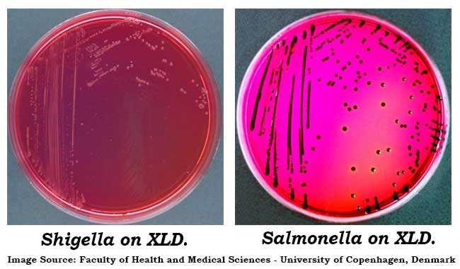 Image result for salmonella and shigella XLD